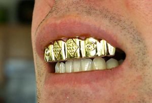 millennials-grillz